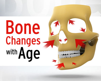 Facial Gavel: Fight Facial Bone Loss